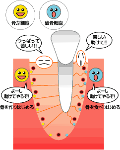 歯の動きの仕組み4